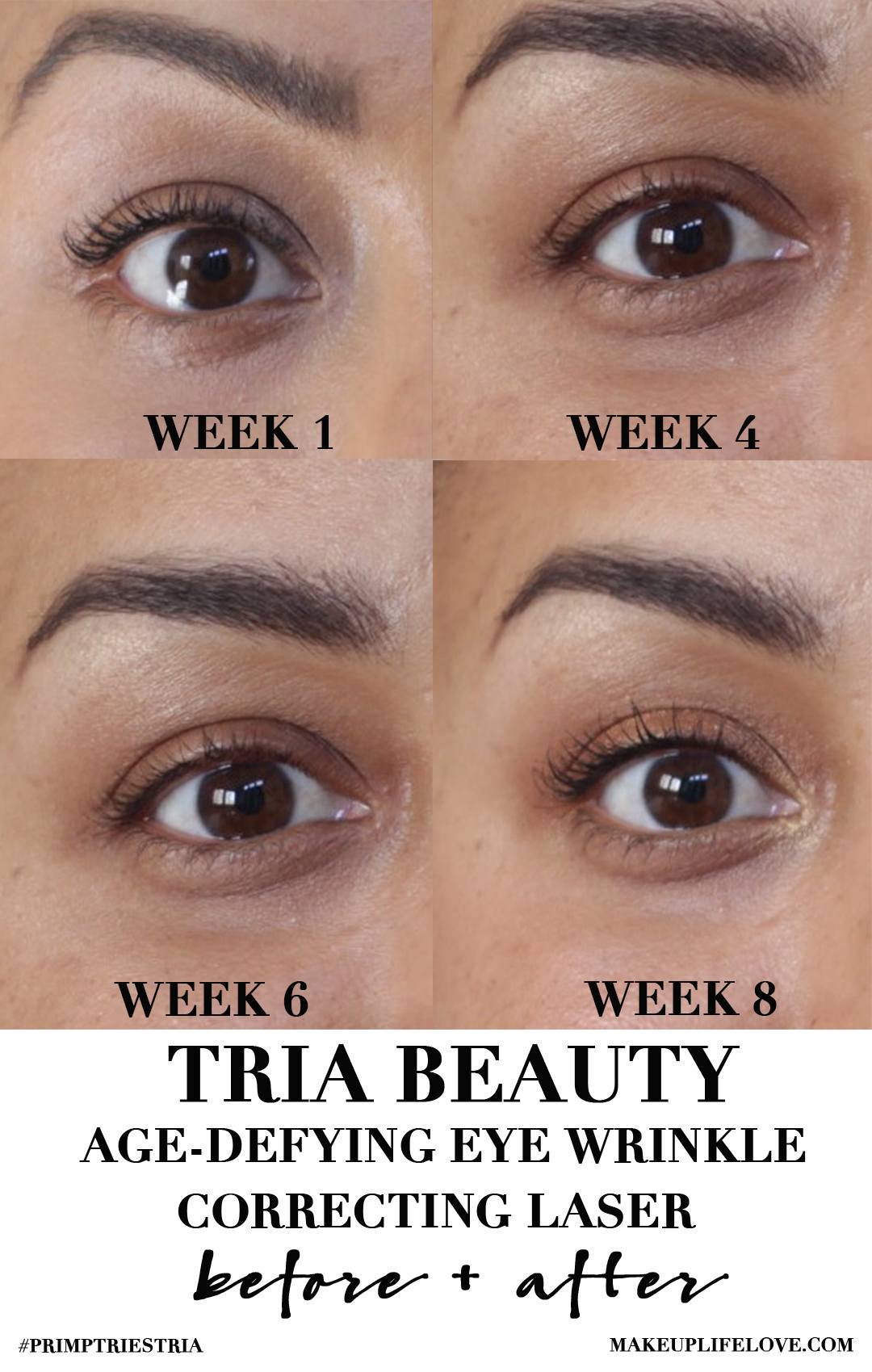 Reversing Time with TRIA Beauty Age Defying Eye Wrinkle Correcting